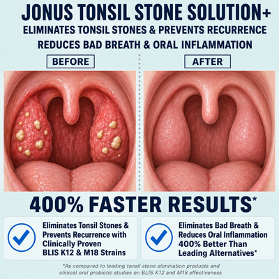 Jonus Oral Probiotic Tablets